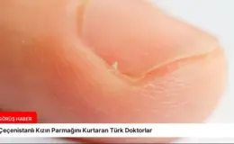 Çeçenistanlı Kızın Parmağını Kurtaran Türk Doktorlar