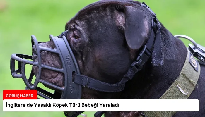 İngiltere’de Yasaklı Köpek Türü Bebeği Yaraladı